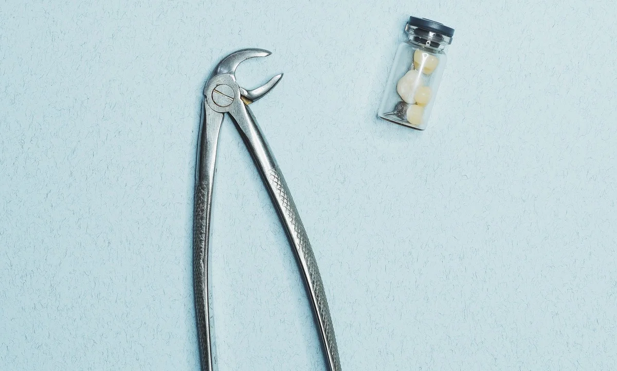 Extracted wisdom tooth next to dental forceps on sterile tray